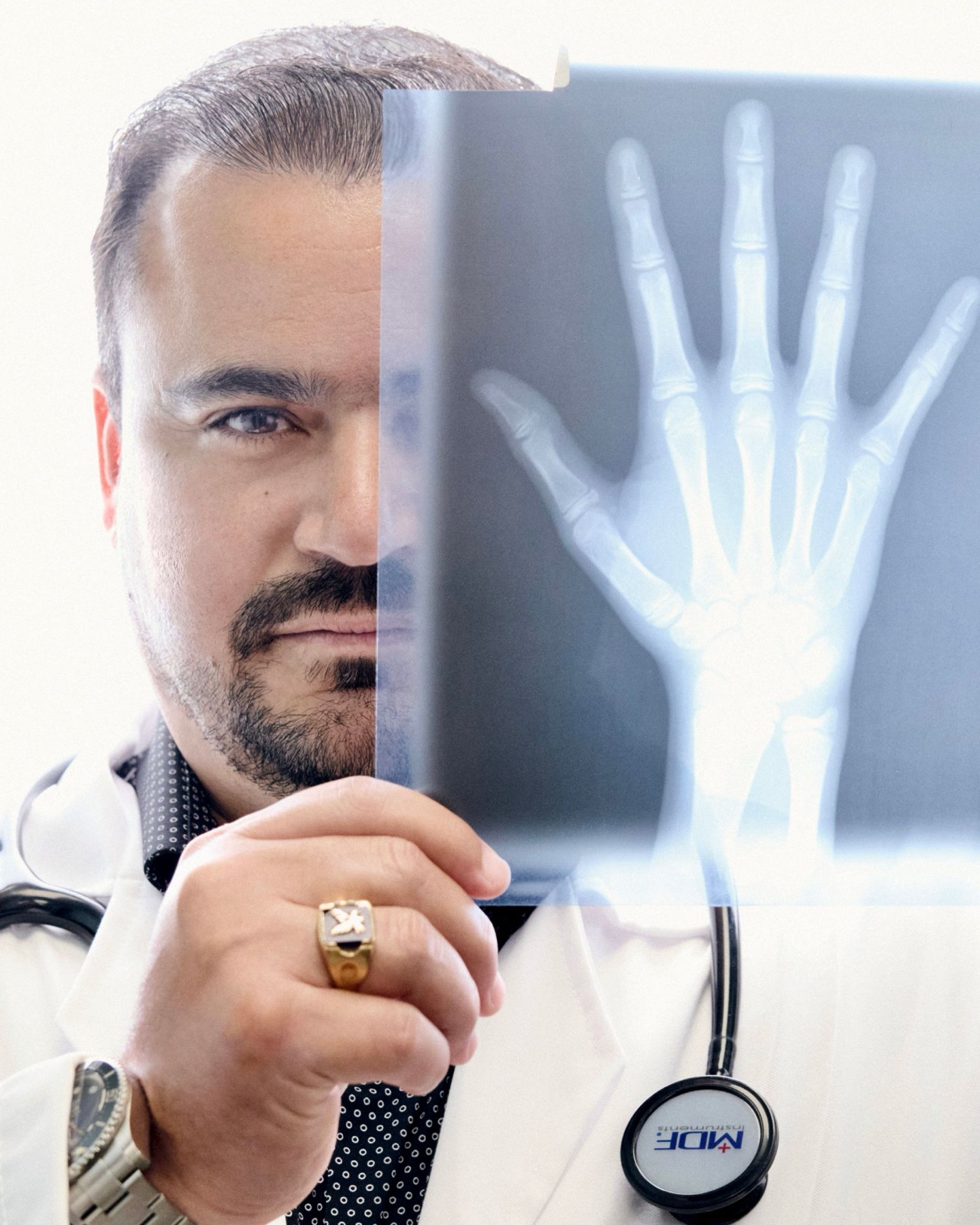 El Dr. Hendry Pascual, con bata blanca, sostiene la radiografía de una mano